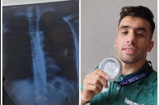 البطل الجزائري الذي حقق ميدالية وضلوعه مكسورة